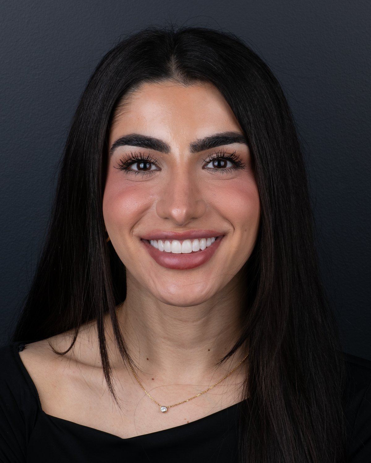 The same patient after her Printed PERL Veneer makeover, with an even, confident smile.