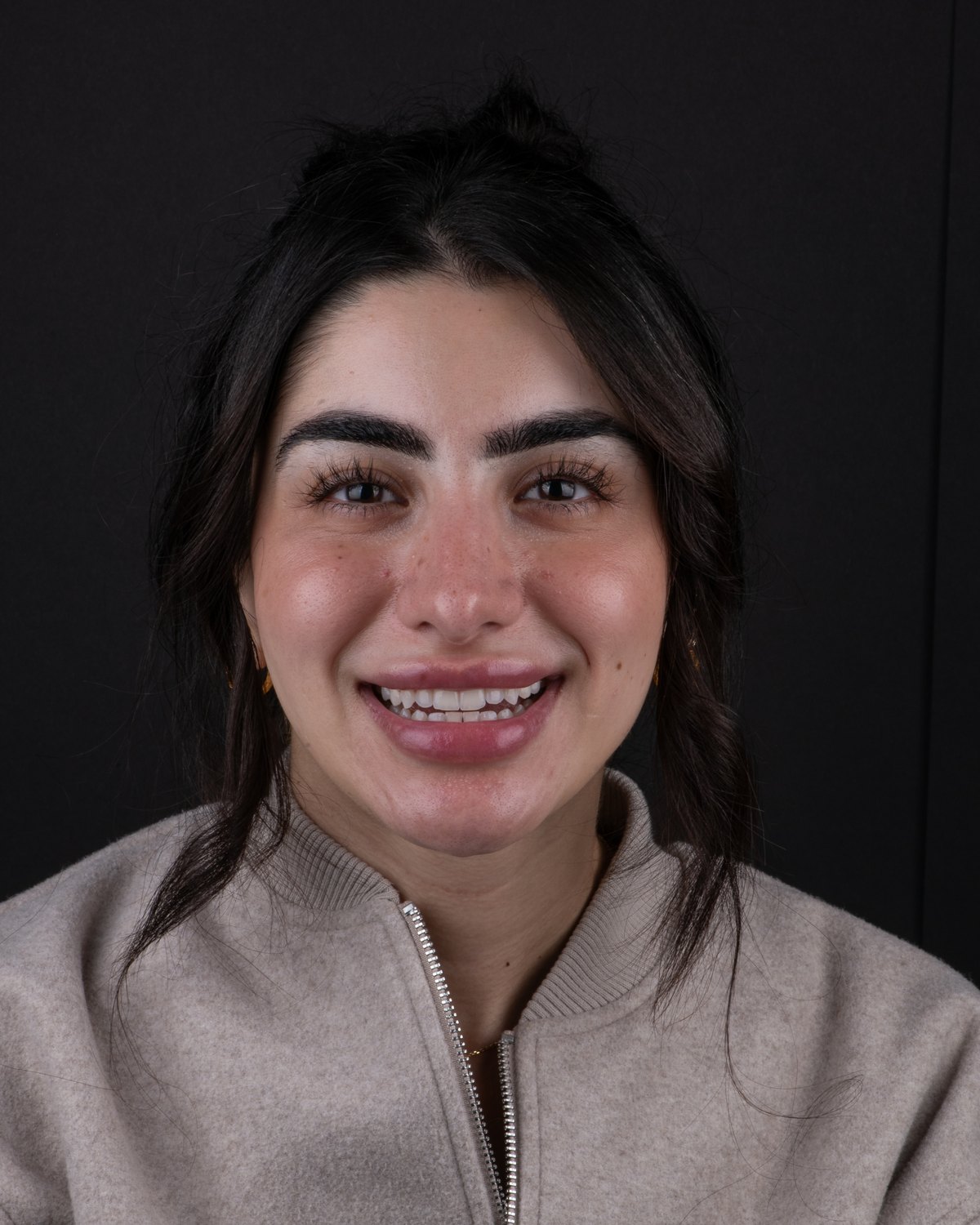 Patient smile before Printed PERL Veneer treatment, with an uneven edge line and slight rotations.