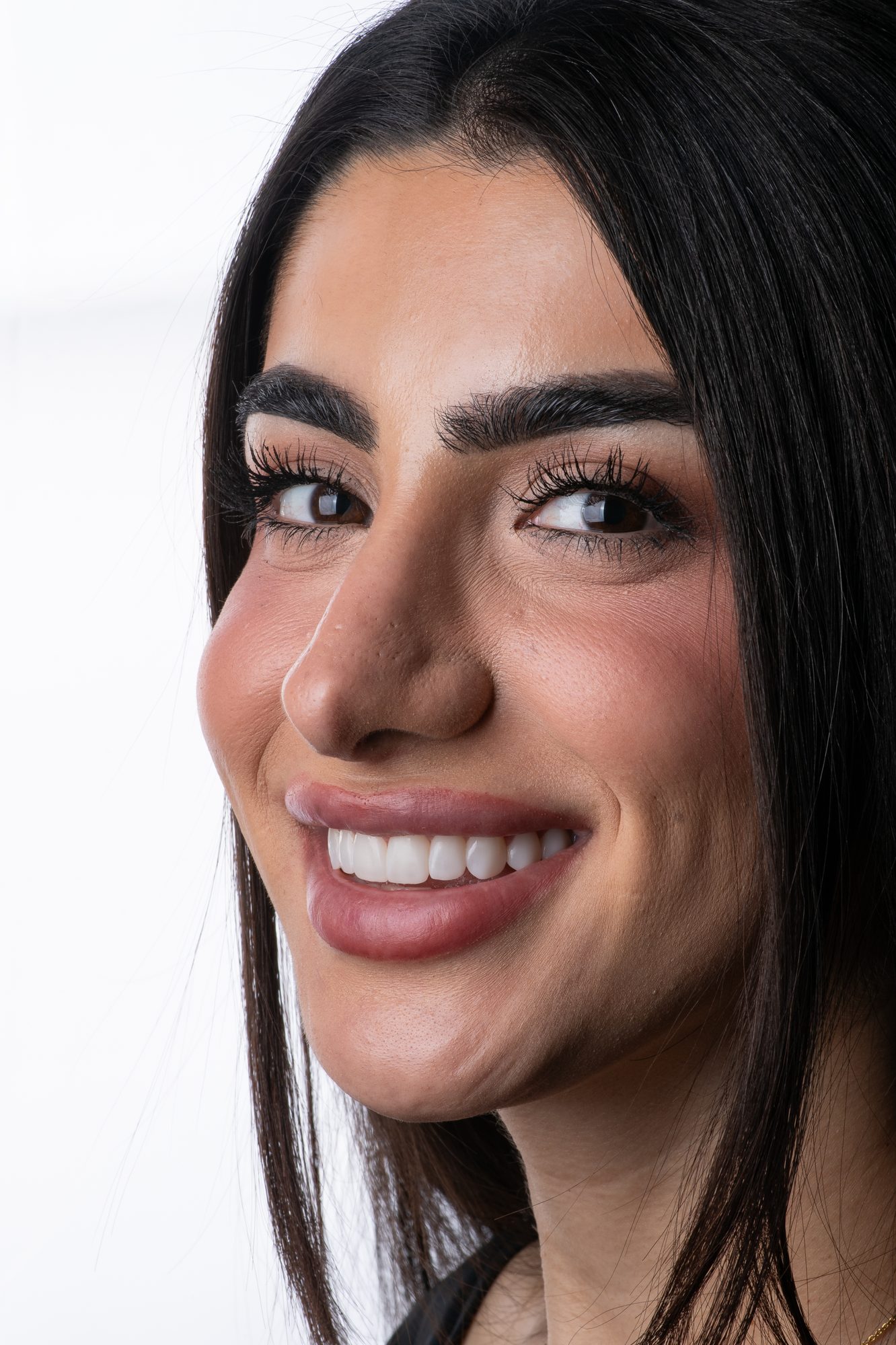 A Smile On Nashville patient with her finished PERL smile