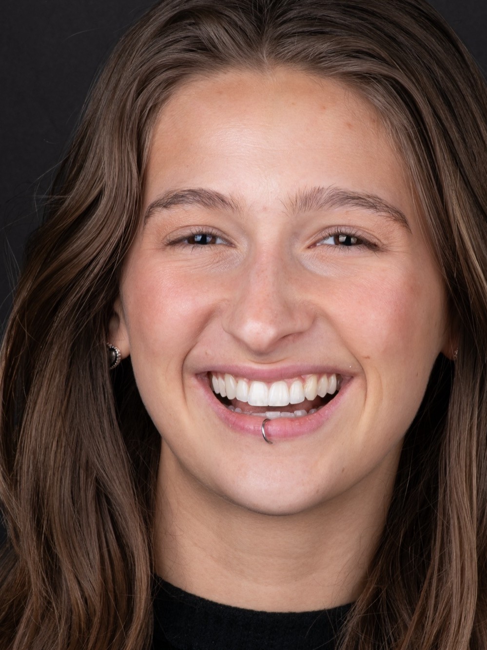 A Smile On Nashville patient smiling after her PERL veneer makeover
