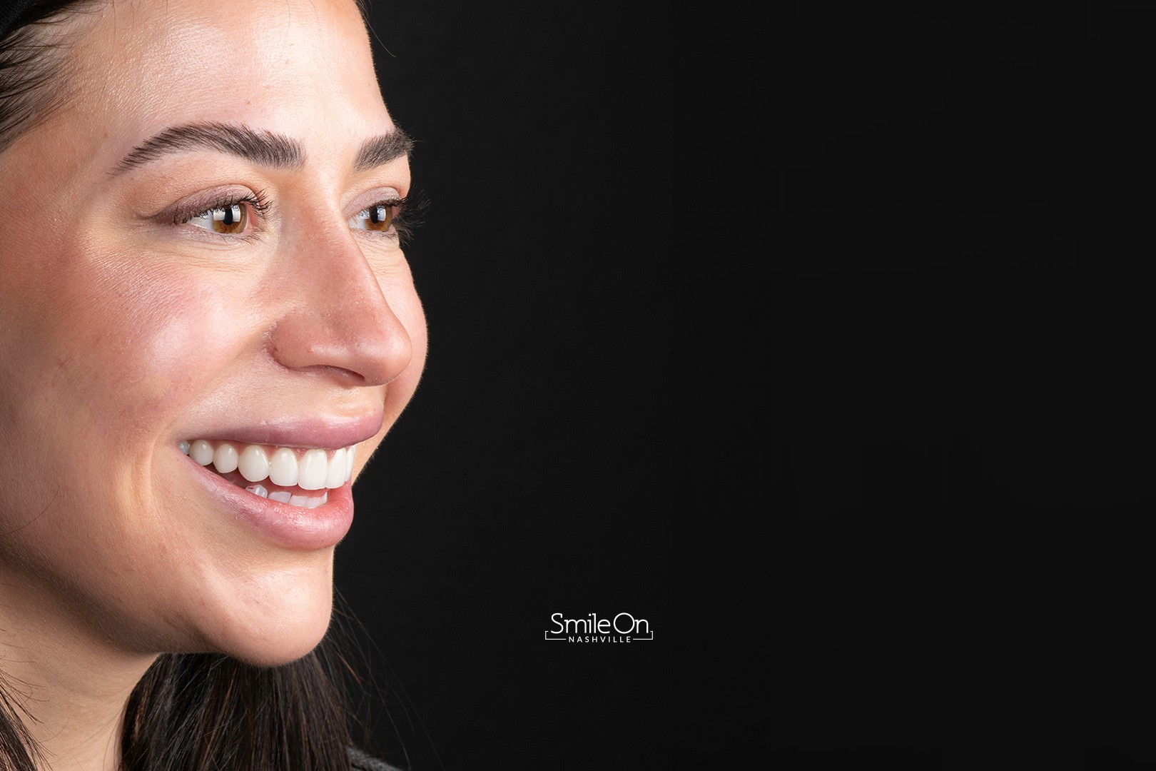 A Smile On Nashville porcelain veneer patient smiling in the studio