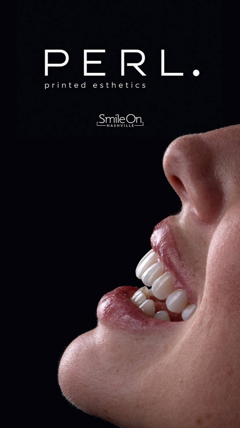 A patient's finished PERL smile in profile
