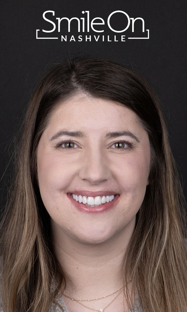 A Smile On Nashville patient with her finished PERL veneer smile, photographed in the studio