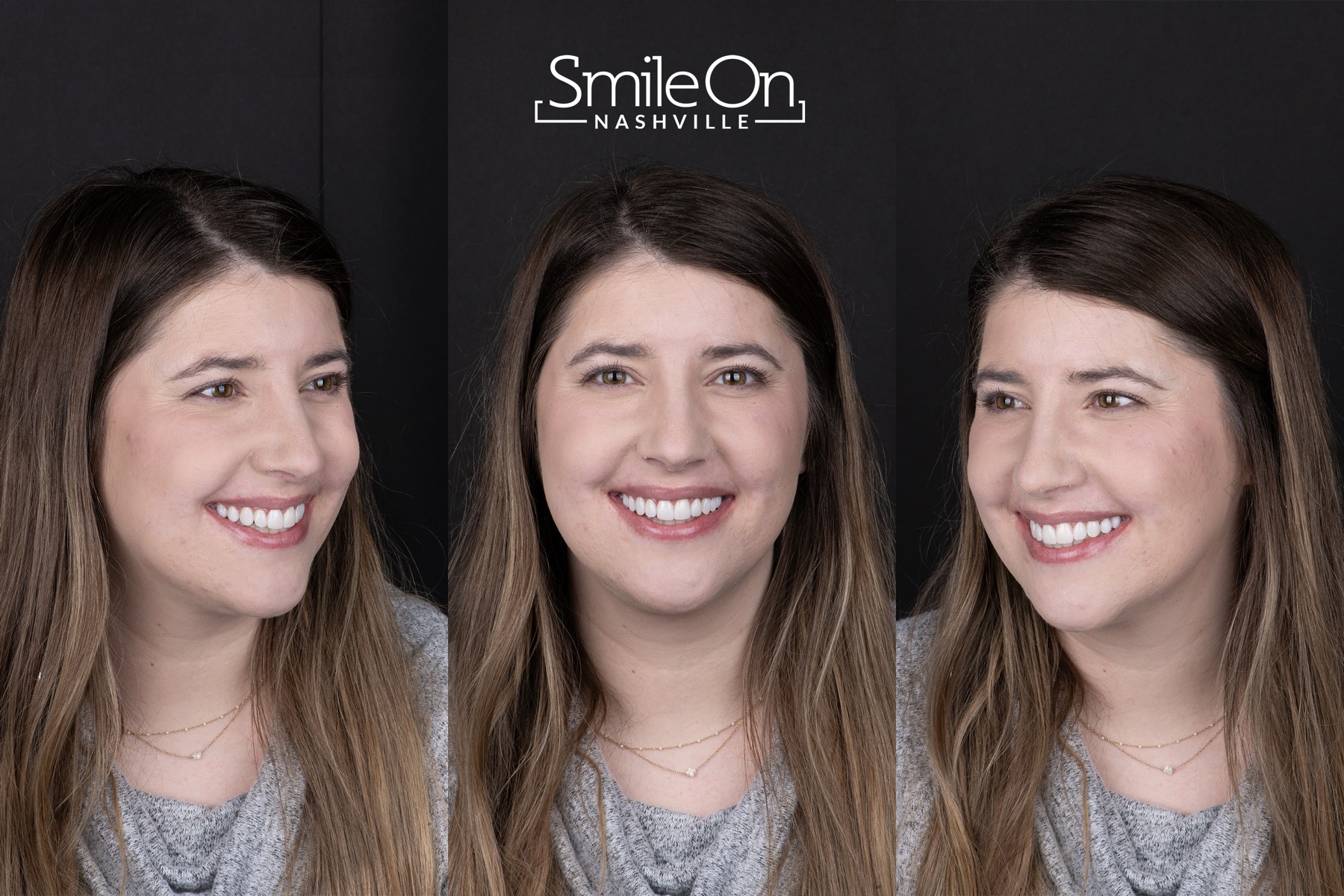A real PERL smile result