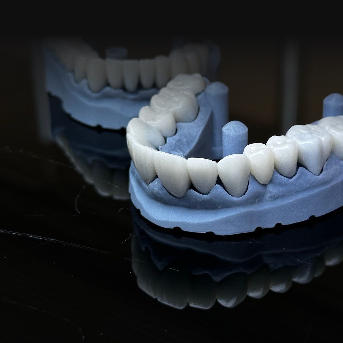 CAD-designed crowns milled onto a 3D-printed dental model at Smile On Nashville